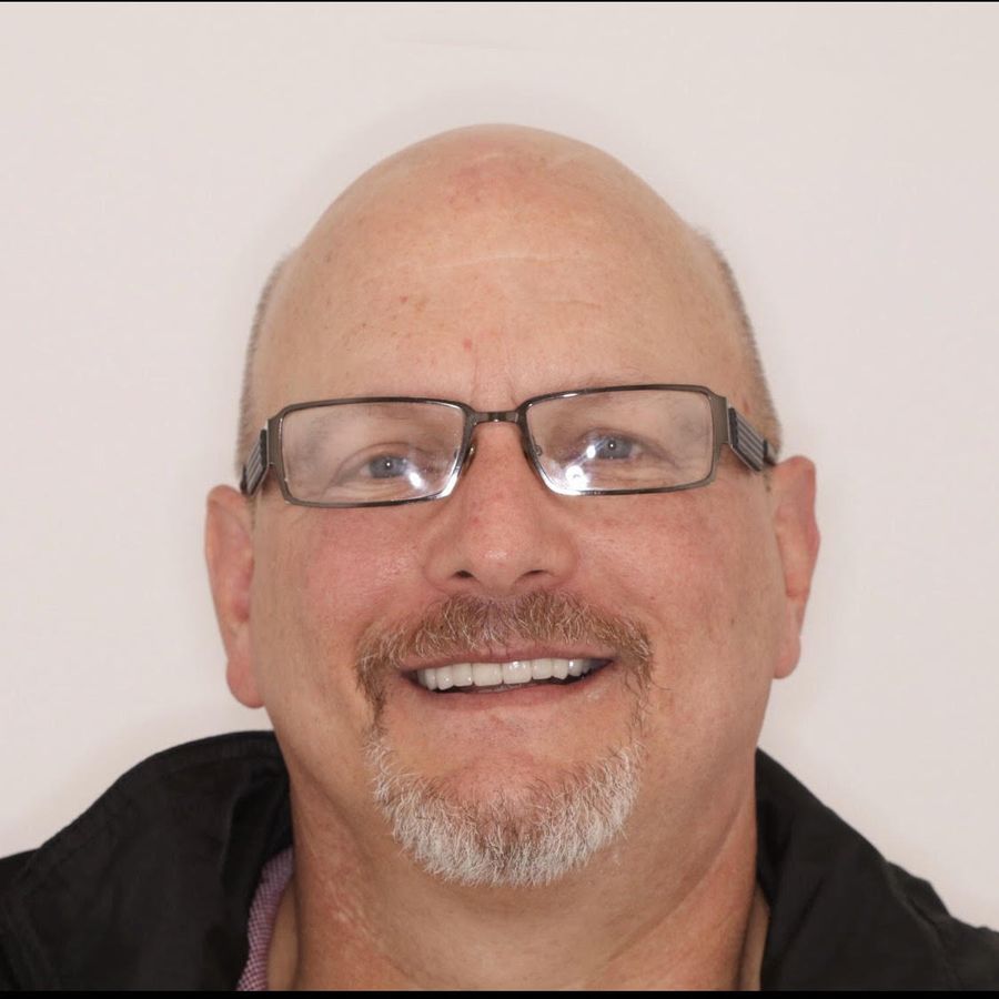 Dental crowns - warren tellgreen - after - 3Dental